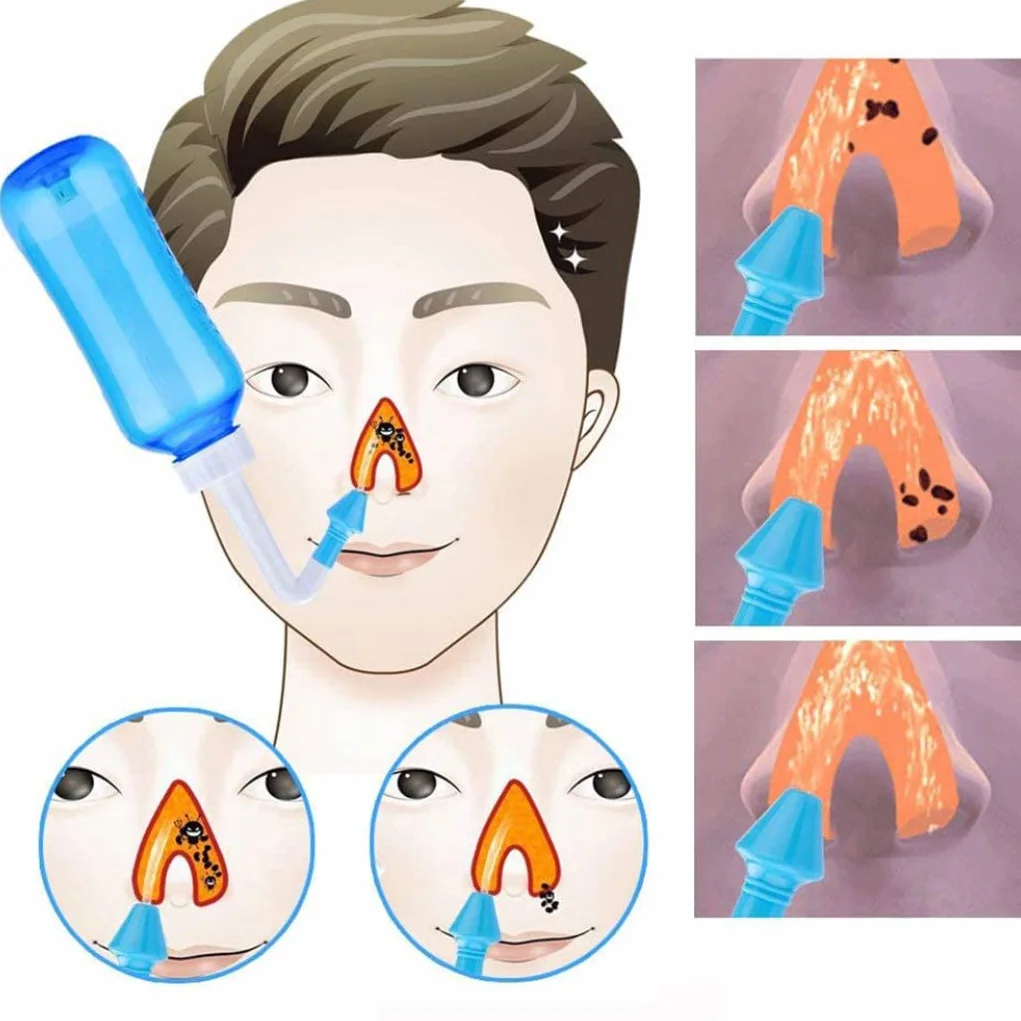 Outil de rinçage des sinus bouteille irrigation nasale à pression enfant adulte