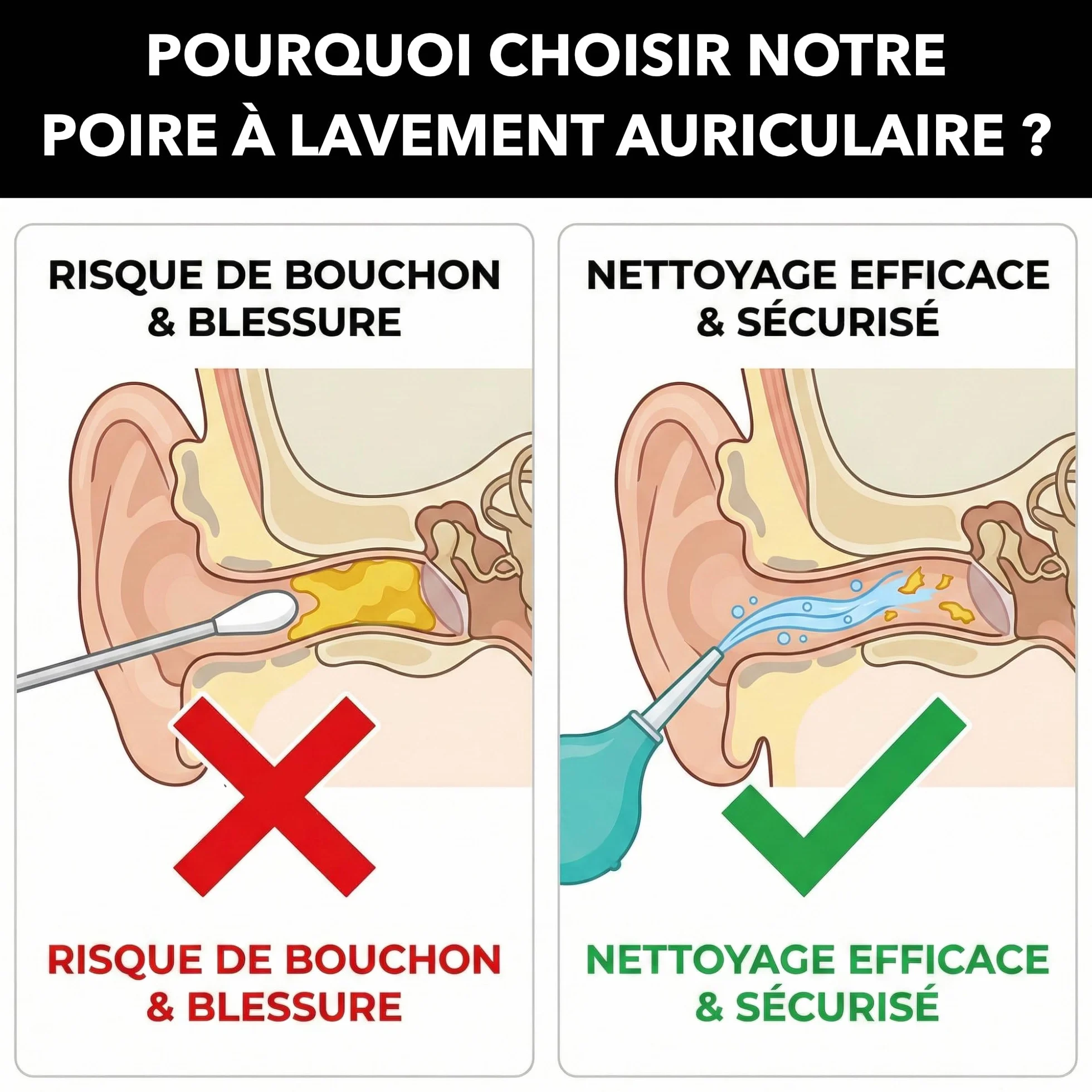 Poire Lavement Oreilles 75ml Haute Précision - Seringue Auriculaire Souple pour Nettoyage du Cérumen