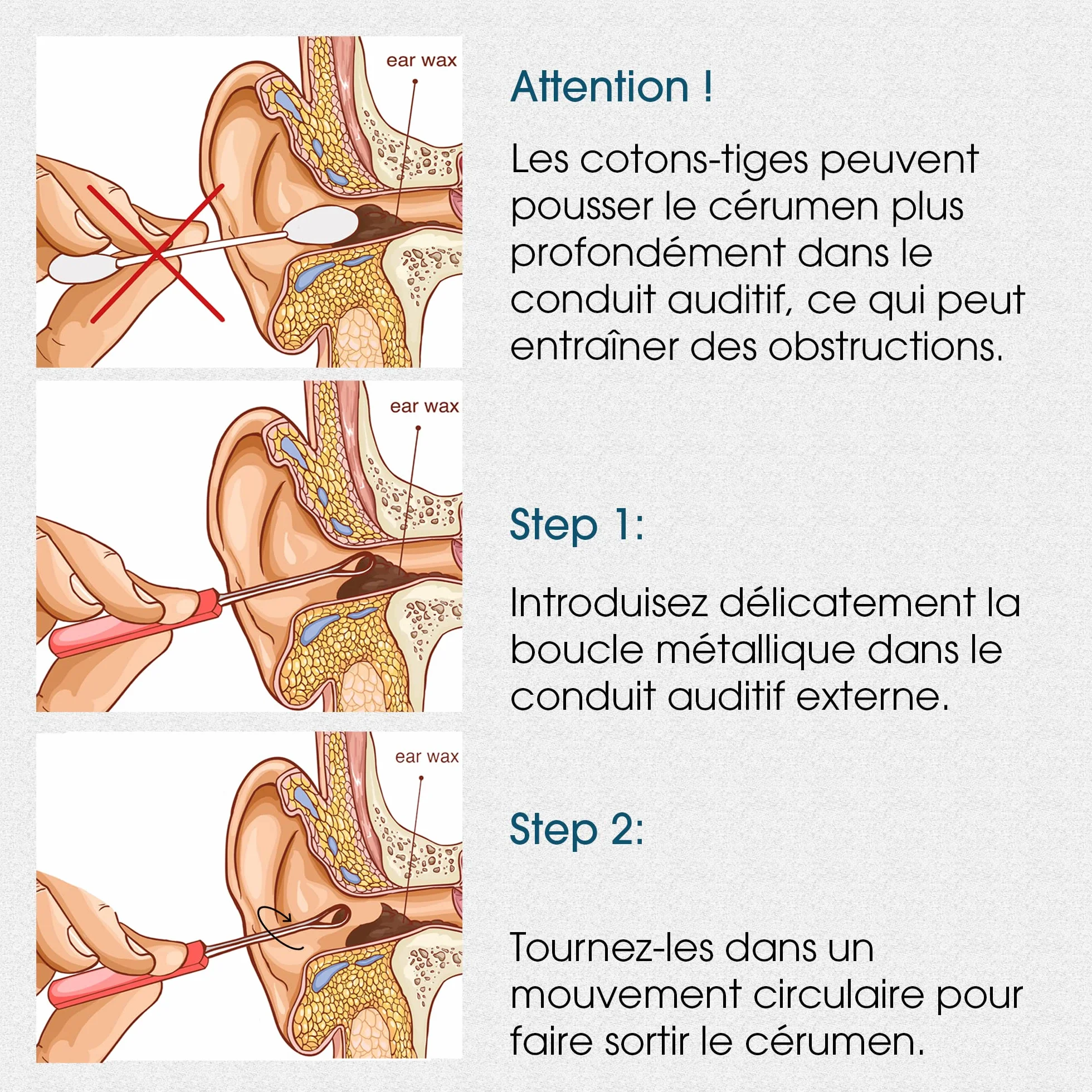 REMOS Cure-oreilles en acier inoxydable 14 cm satin